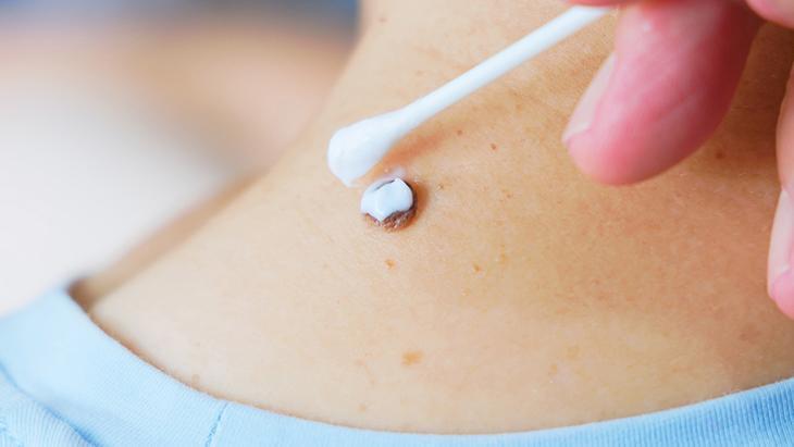 lazerle aldiran da var solusyon suren de her ben masum degil incelenmeli krKRDBh2.jpg